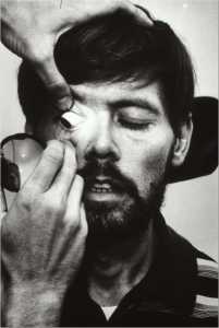 Hanson undergoes weekly eye examination s and treatments, including direct injections into his eye, to combat a virus that is damaging his vision. AIDS destroys the body's immune system, leaving patients vulnerable to a host of viruses and infections that a healthy body would easily overcome.